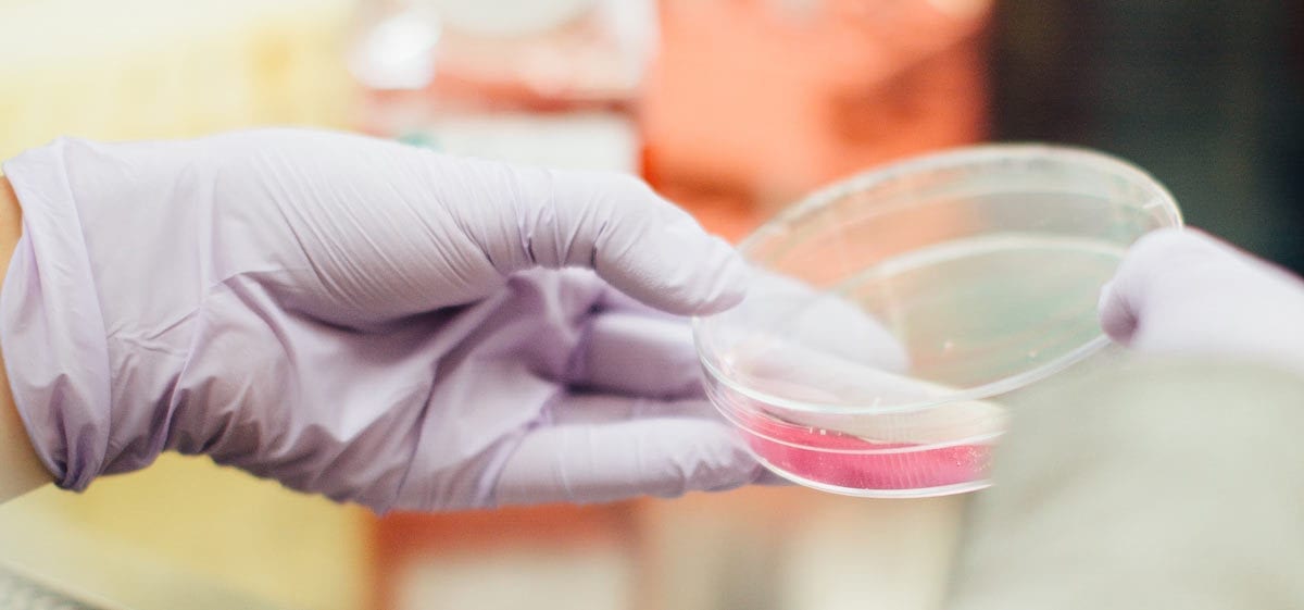 Lab Testing Petri Dish